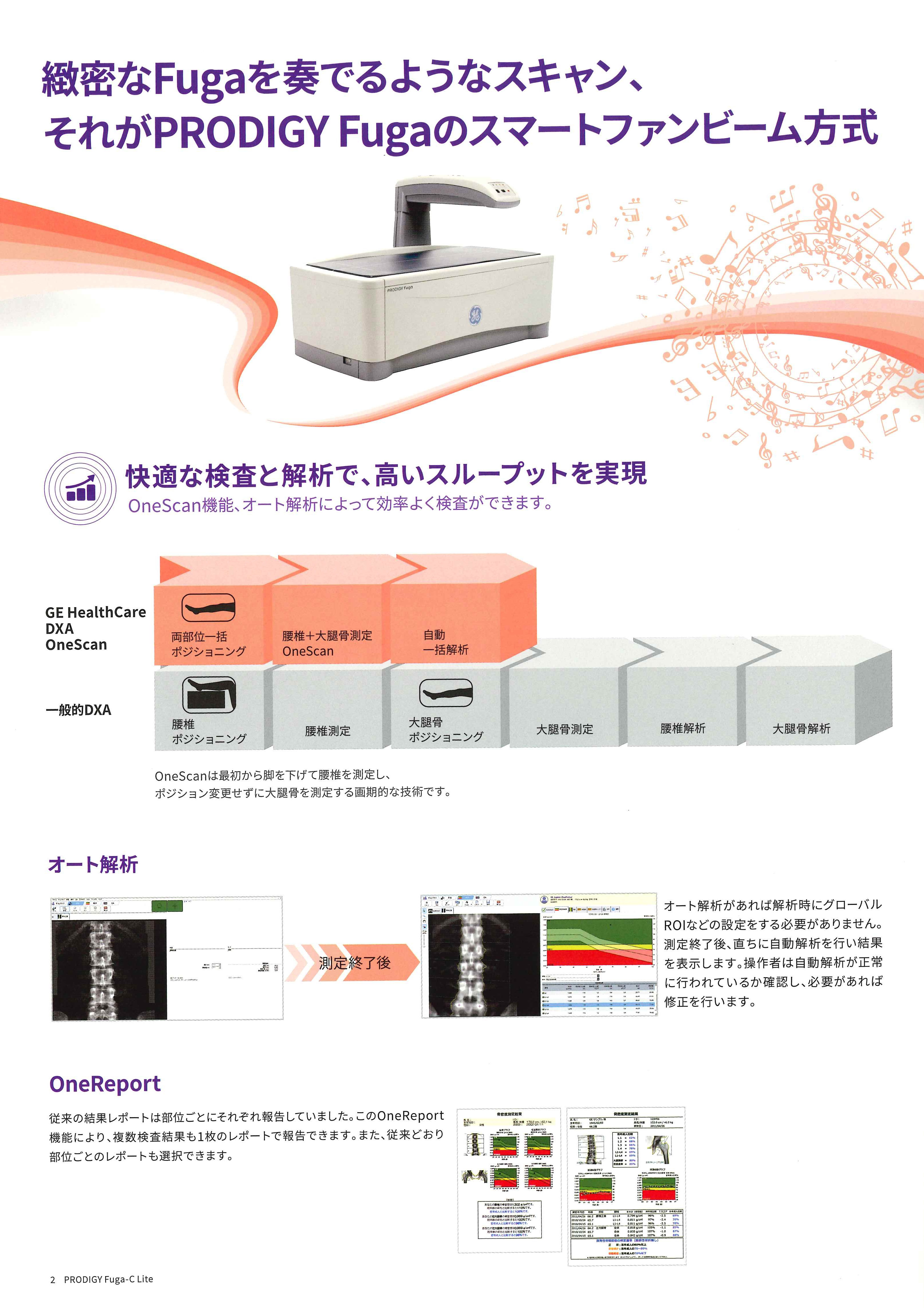 骨密度測定装置の詳細