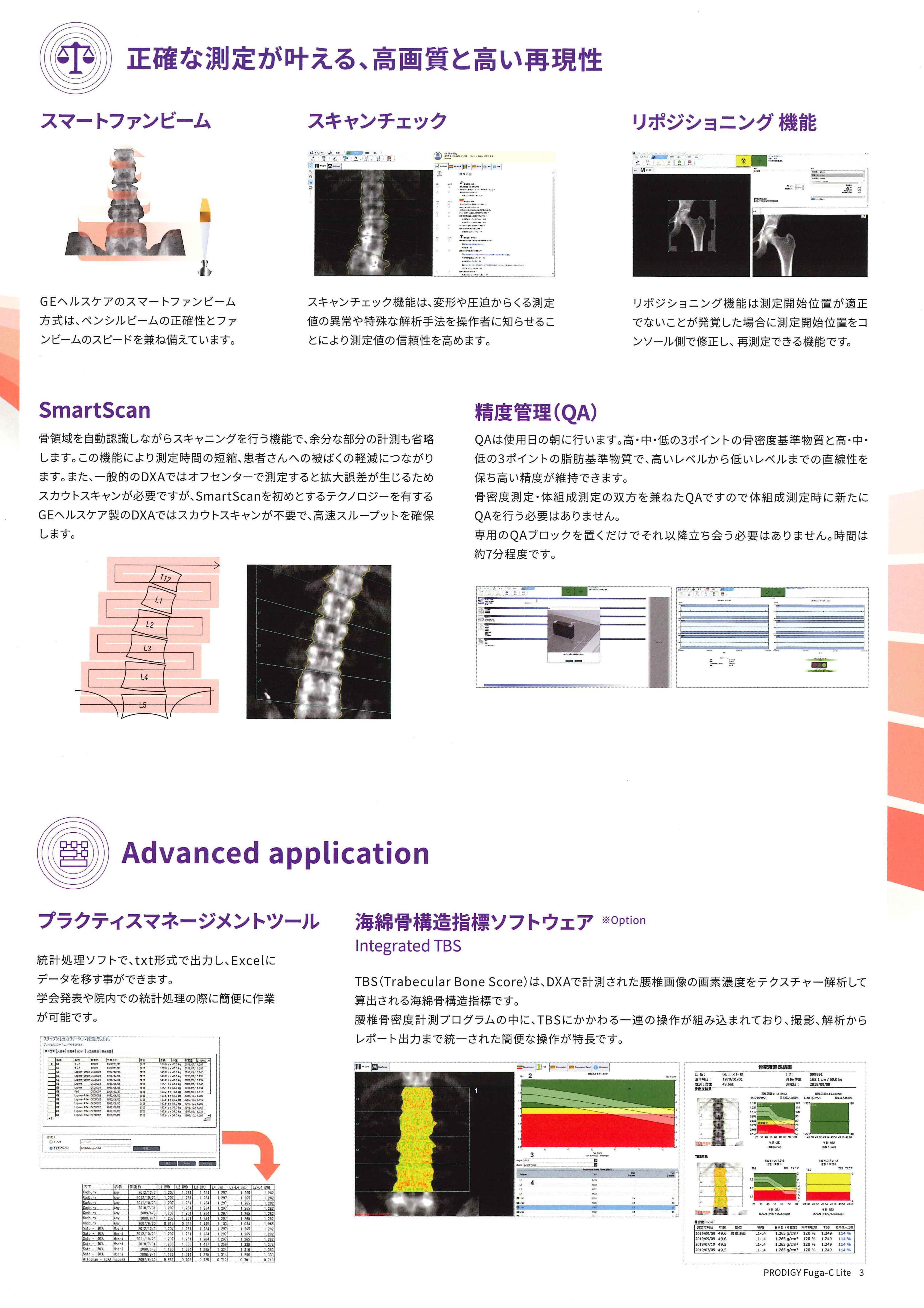 骨密度測定装置の詳細